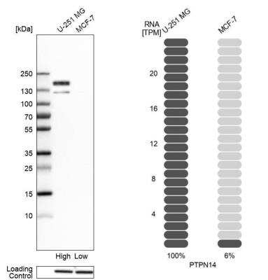 Western Blot: PTPN14/PTPD2 Antibody [NBP2-38712]