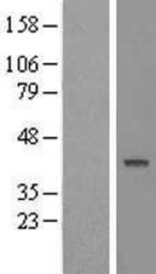 Western Blot: TC-PTP/PTPN2 Overexpression Lysate [NBL1-14972]