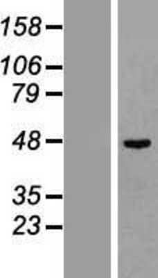 Western Blot: TC-PTP/PTPN2 Overexpression Lysate [NBP2-08070]