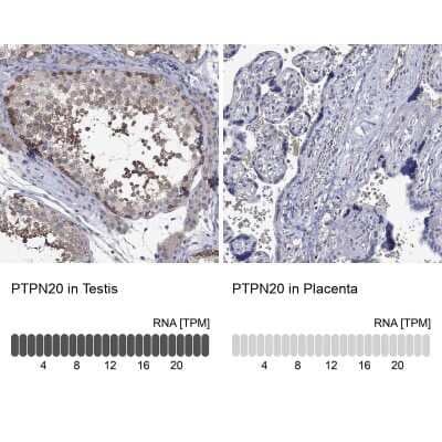 Immunocytochemistry/ Immunofluorescence: PTPN20 Antibody [NBP3-17088]