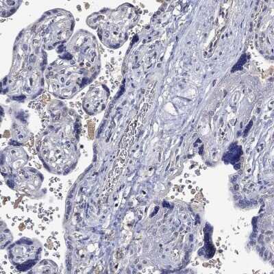 Immunohistochemistry-Paraffin: PTPN20 Antibody [NBP3-17088]