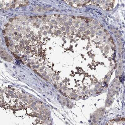 Immunohistochemistry-Paraffin: PTPN20 Antibody [NBP3-17088]