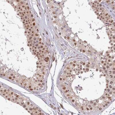 Immunohistochemistry-Paraffin: PTPN20 Antibody [NBP2-46658]