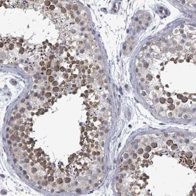 Immunohistochemistry-Paraffin: PTPN20 Antibody [NBP2-46761]