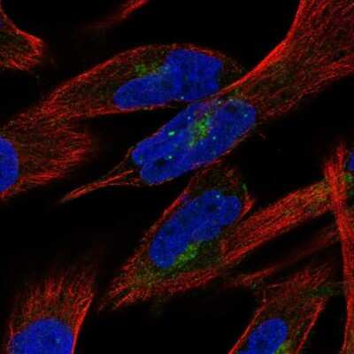 Immunocytochemistry/ Immunofluorescence: PTPN21 Antibody [NBP2-68974]