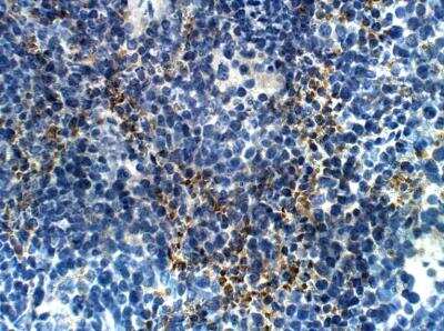 Immunohistochemistry-Paraffin: PTPN21 Antibody [NBP3-12337]