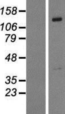 Western Blot: PTPN21 Overexpression Lysate [NBP2-07541]