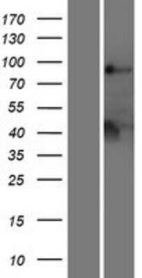 Western Blot: Lyp/PTPN22 Overexpression Lysate [NBL1-14973]