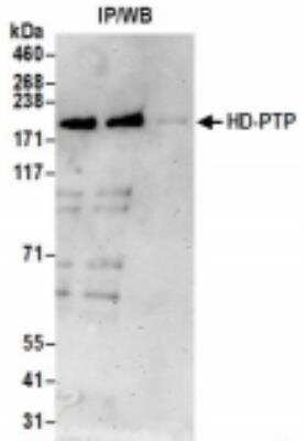 Immunoprecipitation: PTPN23 Antibody [NBP2-36549]