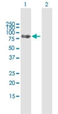 Western Blot: PTPN23 Antibody [H00025930-B01P]