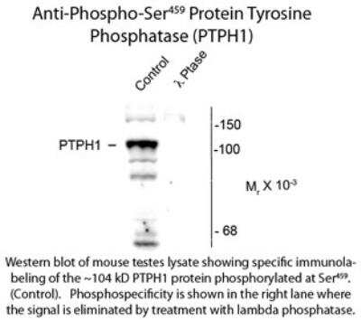 Western Blot: PTPN3 [p Ser459] Antibody [NBP2-29518]