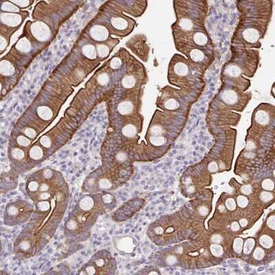 Immunohistochemistry: PTPN3 Antibody [NBP2-48855]