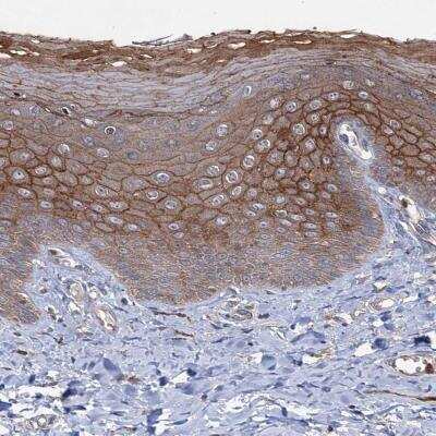 Immunohistochemistry-Paraffin: PTPN3 Antibody [NBP1-80868]