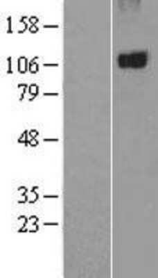 Western Blot: PTPN3 Overexpression Lysate [NBL1-14974]