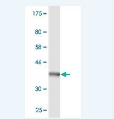 Western Blot: PTPN4 Antibody (2C8) [H00005775-M06]