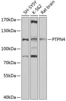 Western Blot: PTPN4 AntibodyBSA Free [NBP2-94872]