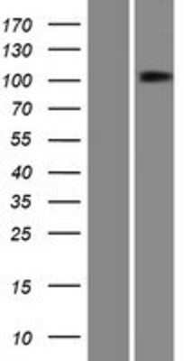 Western Blot: PTPN4 Overexpression Lysate [NBP2-08068]