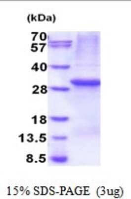 SDS-PAGE: Recombinant Human PTPN4 His Protein [NBP2-52011]