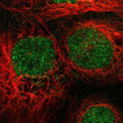 Immunocytochemistry/ Immunofluorescence: SHP-1 Antibody [NBP1-83276]