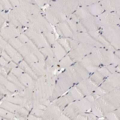 Immunohistochemistry-Paraffin: SHP-1 Antibody [NBP1-83276]