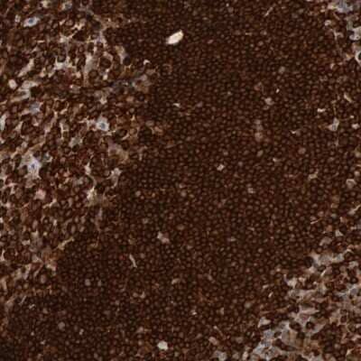 Immunohistochemistry-Paraffin: SHP-1 Antibody [NBP1-83276]