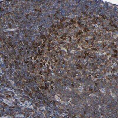 Immunohistochemistry-Paraffin: PTPN7 Antibody [NBP1-81756]
