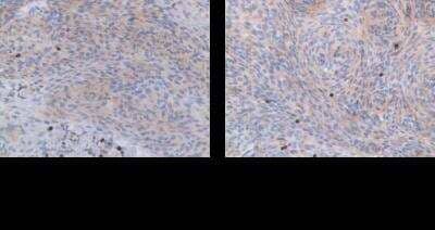 Immunohistochemistry-Paraffin: PTPN7 Antibody [NBP1-81756]