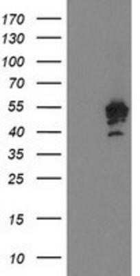 Western Blot: PTPN7 Antibody (OTI3B10)Azide and BSA Free [NBP2-73732]