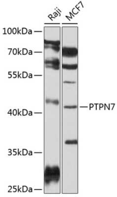 Western Blot: PTPN7 AntibodyBSA Free [NBP3-04491]