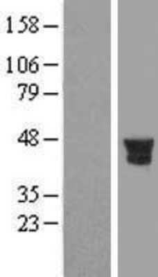 Western Blot: PTPN7 Overexpression Lysate [NBL1-14978]