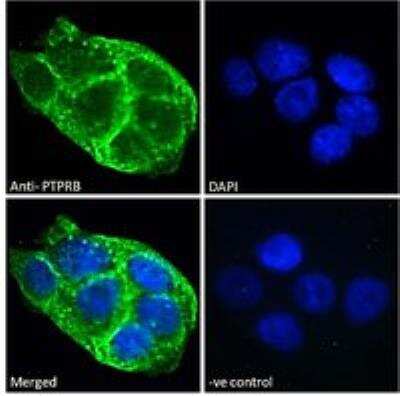 Immunocytochemistry/ Immunofluorescence: PTPRB Antibody [NBP2-88829]