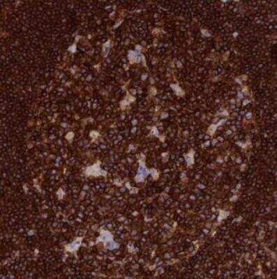 Immunohistochemistry-Paraffin: PTPRCAP Antibody [NBP1-92304]