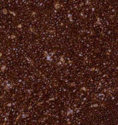 Immunohistochemistry-Paraffin: PTPRCAP Antibody [NBP1-92304]