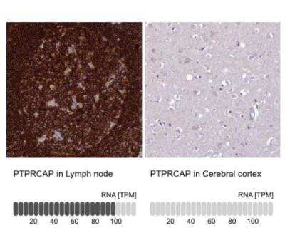 Immunohistochemistry-Paraffin: PTPRCAP Antibody [NBP1-92304]