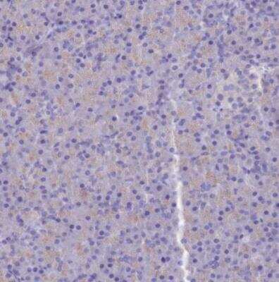 Immunohistochemistry-Paraffin: PTPRCAP Antibody [NBP1-92304]