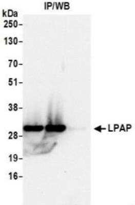 Immunoprecipitation: PTPRCAP Antibody [NBP2-36565]