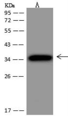 Western Blot: PTPRCAP Antibody [NBP3-12620]