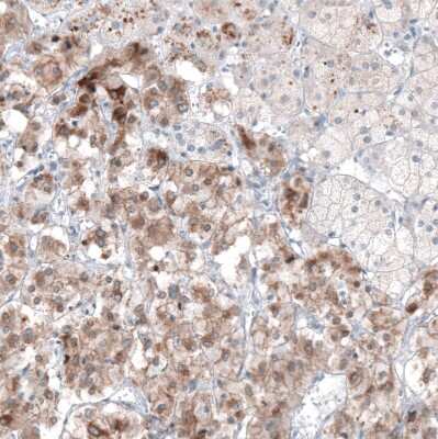 Immunohistochemistry-Paraffin: PTPRD Antibody [NBP2-49153]
