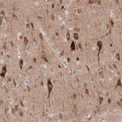 Immunohistochemistry-Paraffin: PTPRD Antibody [NBP2-49153]