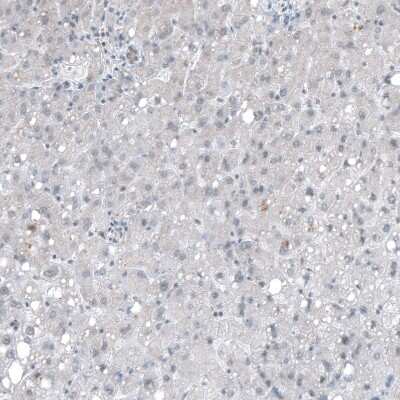 Immunohistochemistry-Paraffin: PTPRD Antibody [NBP2-49153]