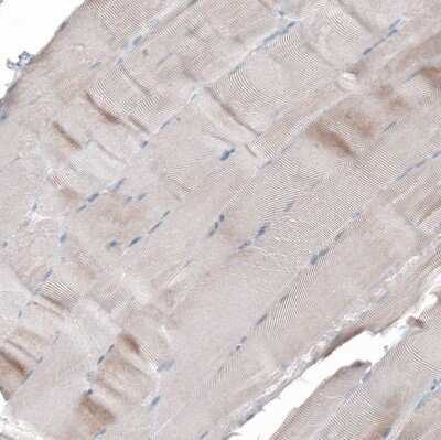 Immunohistochemistry-Paraffin: PTPRD Antibody [NBP2-49153]