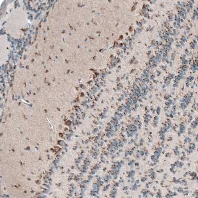 Immunohistochemistry-Paraffin: PTPRD Antibody [NBP2-49153]
