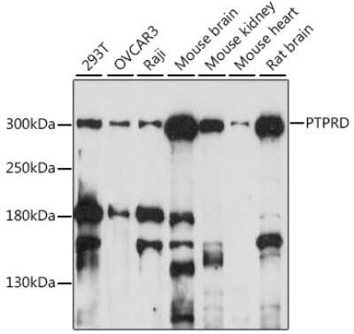 Western Blot: PTPRD AntibodyAzide and BSA Free [NBP2-93396]