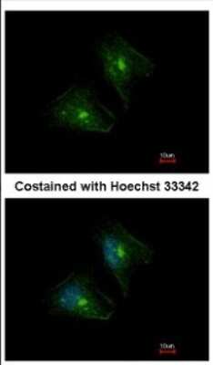 Immunocytochemistry/ Immunofluorescence: PTPRH Antibody [NBP2-20005]