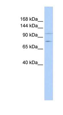 Western Blot: PTPRH Antibody [NBP1-62256]