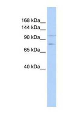 Western Blot: PTPRH Antibody [NBP1-69289]