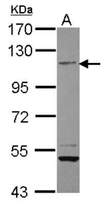 Western Blot: PTPRH Antibody [NBP2-20005]