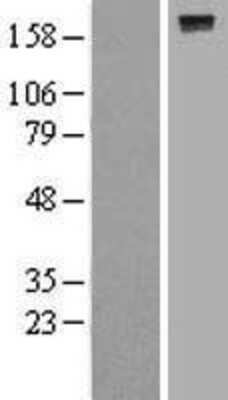 Western Blot: DEP-1/CD148 Overexpression Lysate [NBL1-14985]