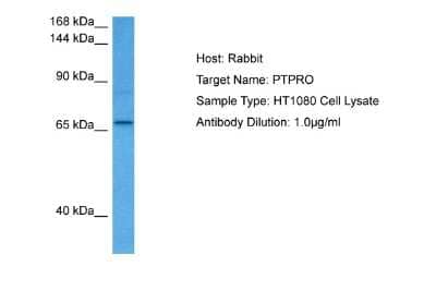 Western Blot: PTPRO Antibody [NBP2-85560]