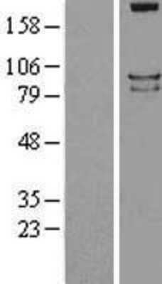 Western Blot: PTP sigma/PTPRS Overexpression Lysate [NBL1-14988]